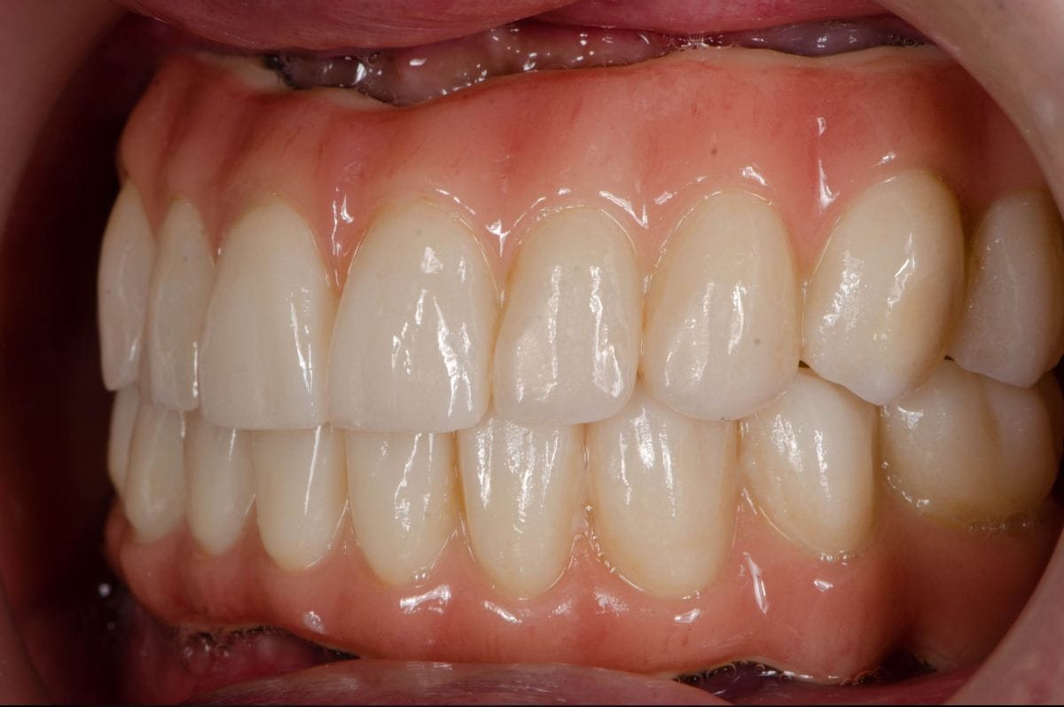 A&B Dental - All In 4